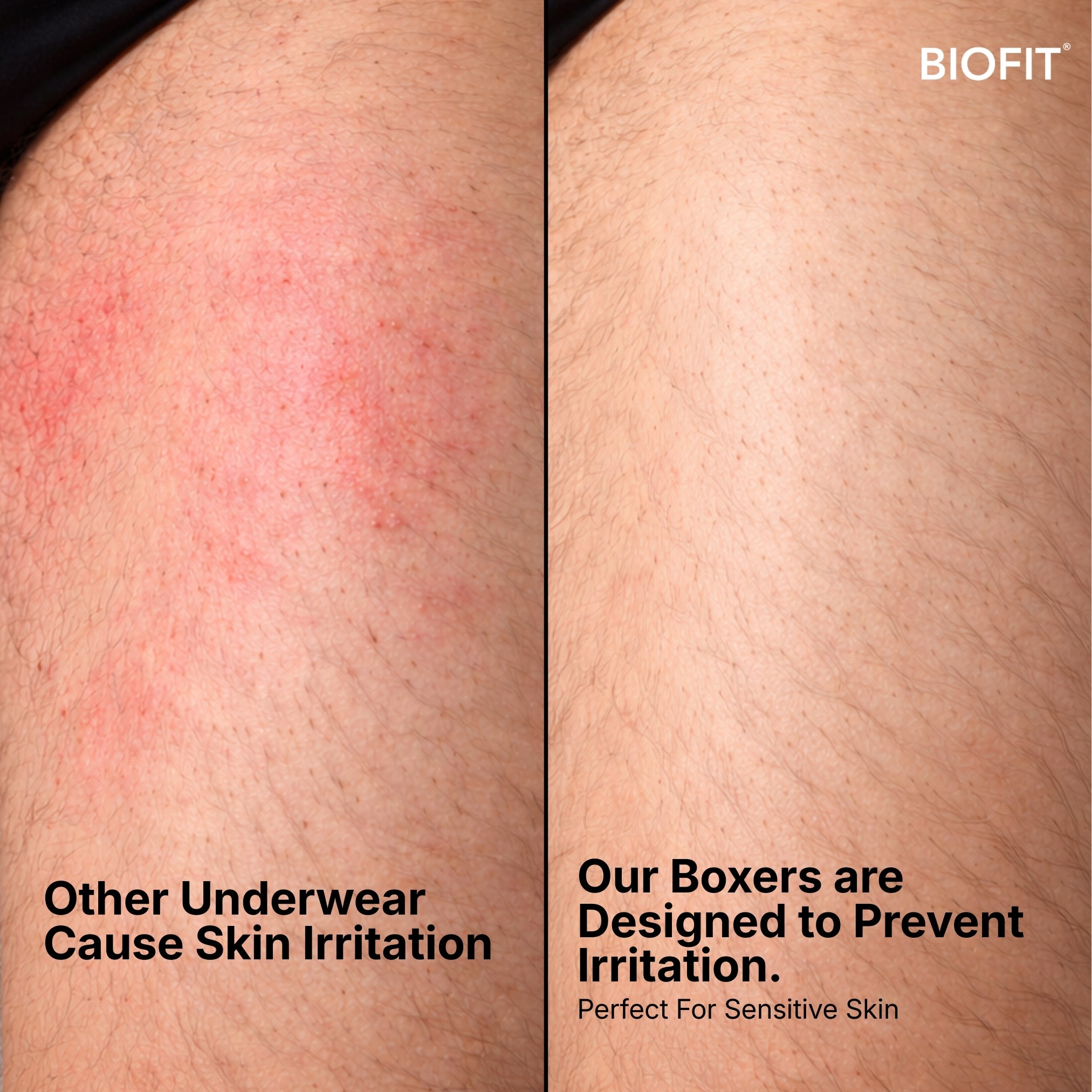 BIOFIT Essentials Boxers 5-Pack Blue | + 5 FREE