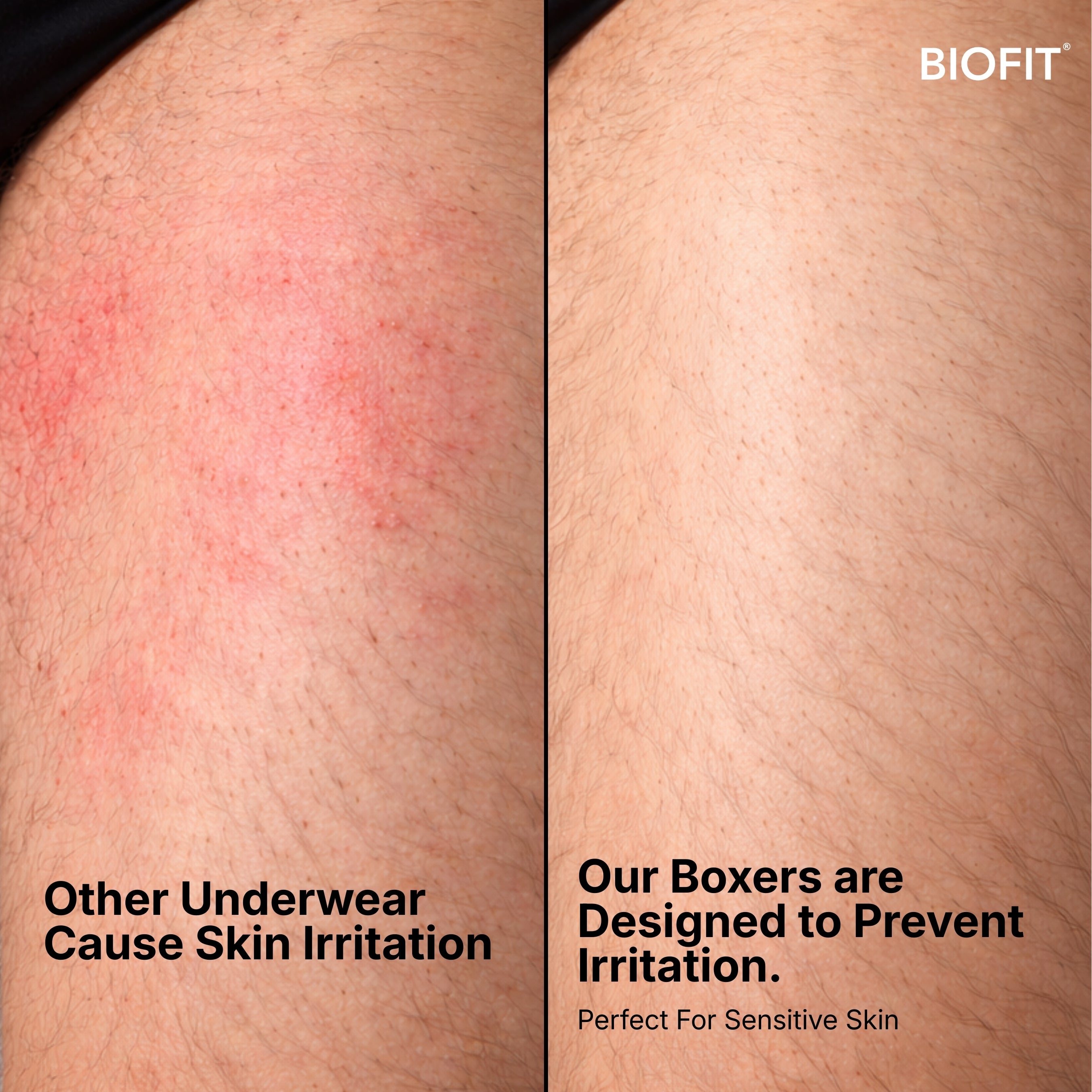 BIOFIT® Bamboo Boxers 5-Pack Multicolor | + 5 FREE